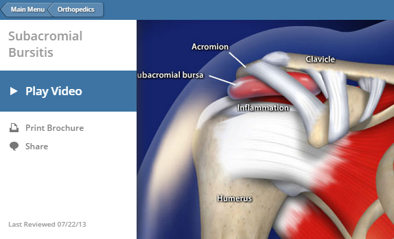 Symptoms of Bursitis | Manhattan Orthopedic Care