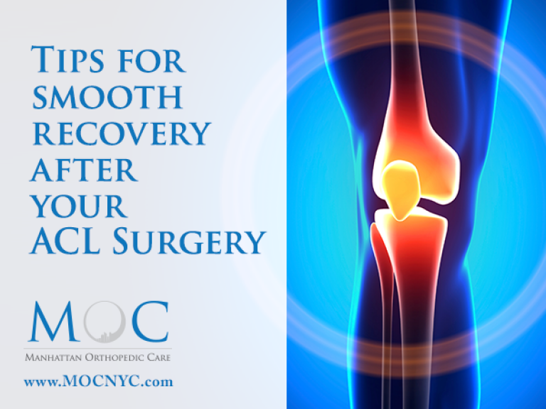 ACL Surgery Recovery Tips - Manhattan Orthopedic Care