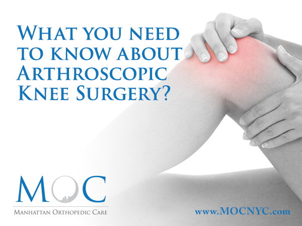 arthroscopic knee surgery