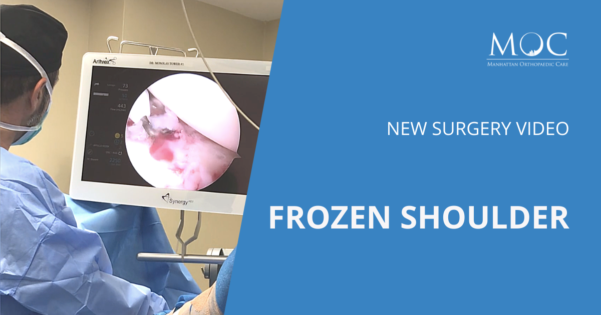 surgery-video-frozen-shoulder-surgery-manhattan-orthopedic-care