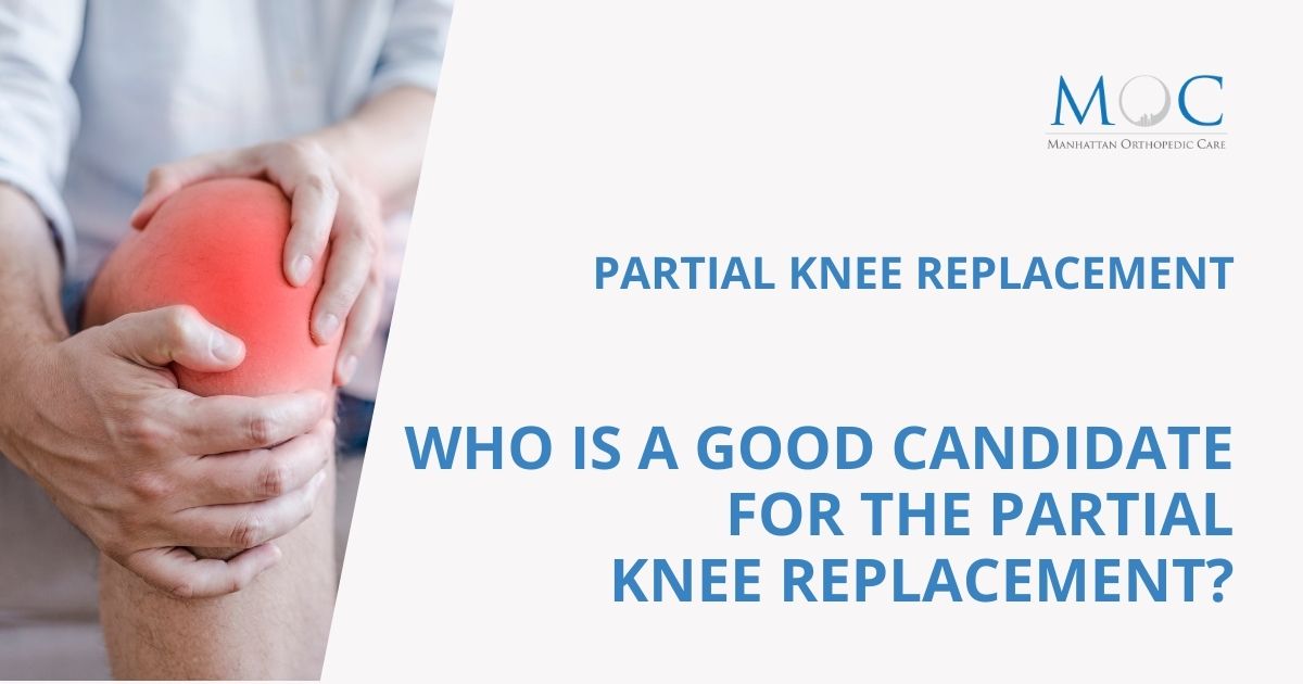 Partial Knee Replacement Procedure