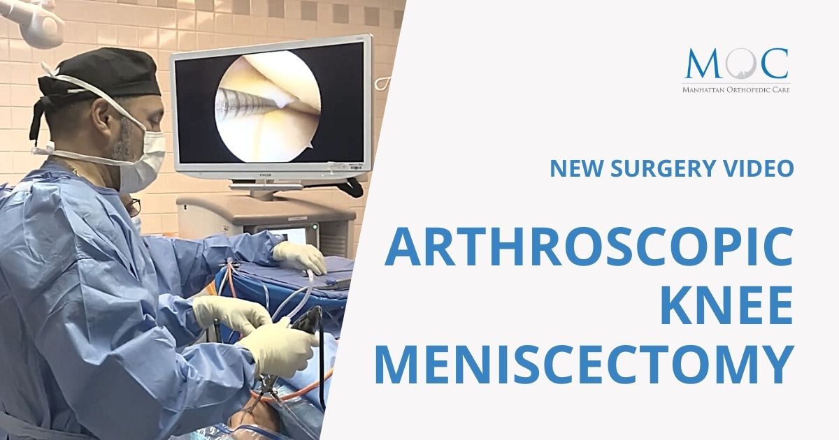 Video: Arthroscopic knee meniscectomy | Manhattan Orthopedic Care